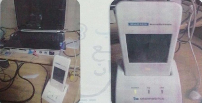 Transient evoked  otoacoustic emission Equipment